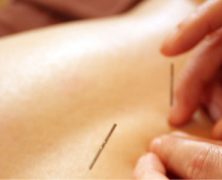 Acupuncture Melbourne – Why You Should Visit an Acupuncture Clinic