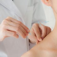 How To Find The Best Acupuncturists