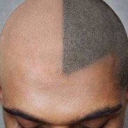 Bald Head Hair Tattoo – Tips and Ideas For Your New Tattoo