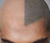 Bald Head Hair Tattoo – Tips and Ideas For Your New Tattoo