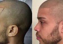 Hairline Tattoos For Men