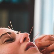 Acupuncture Melbourne is a form of Holistic Medicine