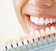 Achieve a Radiant Smile with Teeth Whitening at Dentistry At The Cross