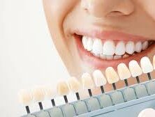 Achieve a Radiant Smile with Teeth Whitening at Dentistry At The Cross
